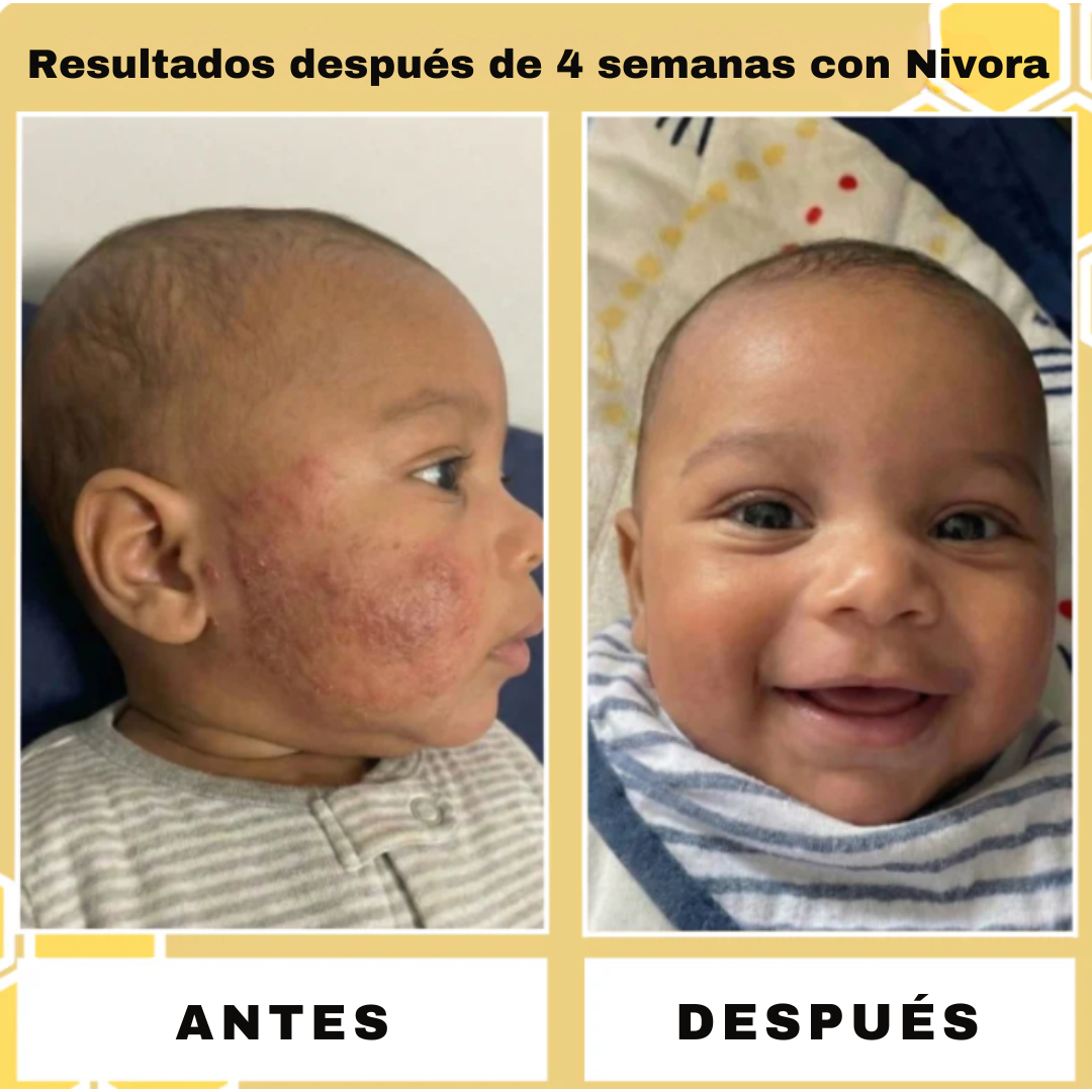 Bálsamo Reparador de Sebo y Miel Nivora