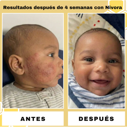 Bálsamo Reparador de Sebo y Miel Nivora