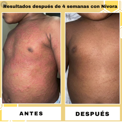 Bálsamo Reparador de Sebo y Miel Nivora